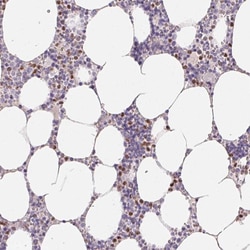 Invitrogen PADI4 Polyclonal Antibody 100 &mu;L; Unconjugated:Antibodies,