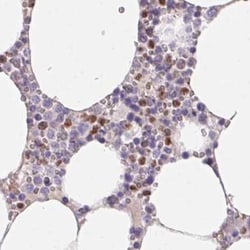 Invitrogen PADI4 Polyclonal Antibody 100 &mu;L; Unconjugated:Antibodies,