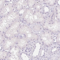 Invitrogen PADI4 Polyclonal Antibody 100 &mu;L; Unconjugated:Antibodies,