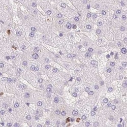 Invitrogen PADI4 Polyclonal Antibody 100 &mu;L; Unconjugated:Antibodies,