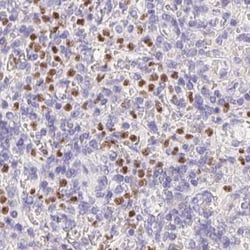 Invitrogen PADI4 Polyclonal Antibody 100 &mu;L; Unconjugated:Antibodies,