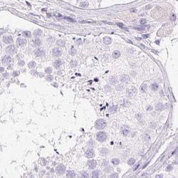 Invitrogen PADI4 Polyclonal Antibody 100 &mu;L; Unconjugated:Antibodies,