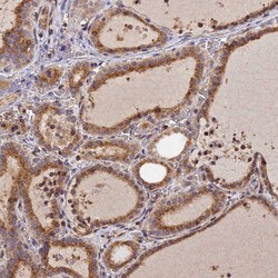 Invitrogen PEX3 Polyclonal Antibody 100 &mu;L; Unconjugated:Antibodies,