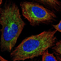Invitrogen APC1 Polyclonal Antibody 100 &mu;L; Unconjugated:Antibodies,
