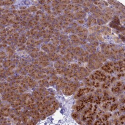 Invitrogen APC1 Polyclonal Antibody 100 &mu;L; Unconjugated:Antibodies,