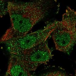 Invitrogen HuD Polyclonal Antibody 100 &mu;L; Unconjugated:Antibodies,