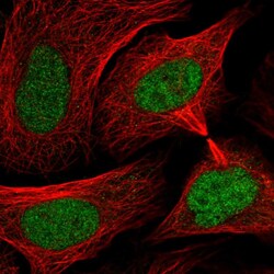 Invitrogen SMC3 Polyclonal Antibody 100 &mu;L; Unconjugated:Antibodies,