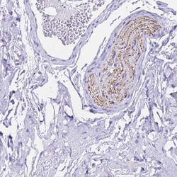 Invitrogen FAM72A Polyclonal Antibody 100 &mu;L; Unconjugated:Antibodies,