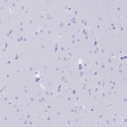 Invitrogen CD5 Polyclonal Antibody 100 &mu;L; Unconjugated:Antibodies,