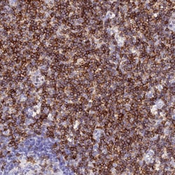 Invitrogen CD5 Polyclonal Antibody 100 &mu;L; Unconjugated:Antibodies,
