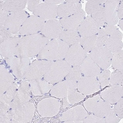 Invitrogen CD5 Polyclonal Antibody 100 &mu;L; Unconjugated:Antibodies,