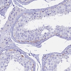 Invitrogen CD5 Polyclonal Antibody 100 &mu;L; Unconjugated:Antibodies,