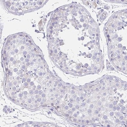 Invitrogen Uromodulin Polyclonal Antibody 100 &mu;L; Unconjugated:Antibodies,