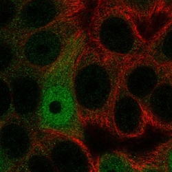Invitrogen AP5S1 Polyclonal Antibody 100 &mu;L; Unconjugated:Antibodies,
