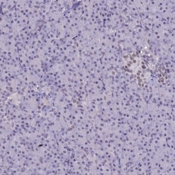 Invitrogen SAE1 Polyclonal Antibody 100 &mu;L; Unconjugated:Antibodies,