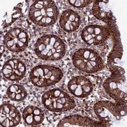 Invitrogen GALK2 Polyclonal Antibody 100 &mu;L; Unconjugated:Antibodies,