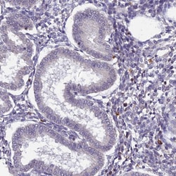 Invitrogen GALK2 Polyclonal Antibody 100 &mu;L; Unconjugated:Antibodies,