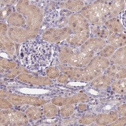 Invitrogen GALK2 Polyclonal Antibody 100 &mu;L; Unconjugated:Antibodies,
