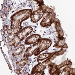 Invitrogen GALK2 Polyclonal Antibody 100 &mu;L; Unconjugated:Antibodies,