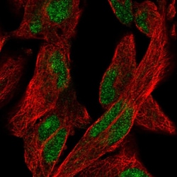 Invitrogen KGF Polyclonal Antibody 100 &mu;L; Unconjugated:Antibodies,