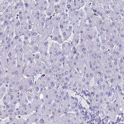 Invitrogen KGF Polyclonal Antibody 100 &mu;L; Unconjugated:Antibodies,