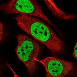 Invitrogen RALY Polyclonal Antibody 100 &mu;L; Unconjugated:Antibodies,