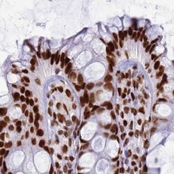 Invitrogen RALY Polyclonal Antibody 100 &mu;L; Unconjugated:Antibodies,