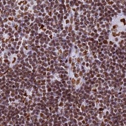 Invitrogen RALY Polyclonal Antibody 100 &mu;L; Unconjugated:Antibodies,