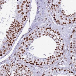 Invitrogen RALY Polyclonal Antibody 100 &mu;L; Unconjugated:Antibodies,