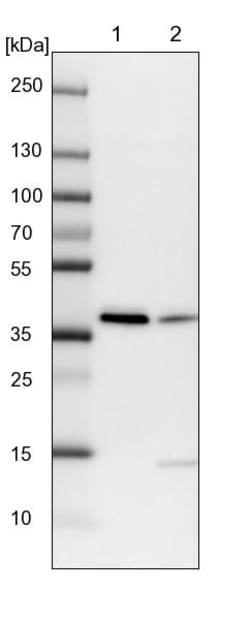 Invitrogen RALY Polyclonal Antibody 100 &mu;L; Unconjugated:Antibodies,