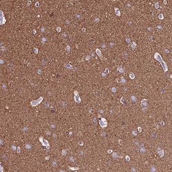 Invitrogen TUBA1A Polyclonal Antibody 100 &mu;L; Unconjugated:Antibodies,