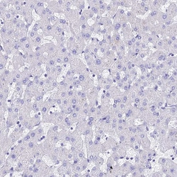 Invitrogen TUBA1A Polyclonal Antibody 100 &mu;L; Unconjugated:Antibodies,