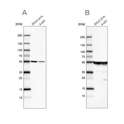 Invitrogen TUBA1A Polyclonal Antibody 100 &mu;L; Unconjugated:Antibodies,