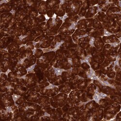 Invitrogen RPL17 Polyclonal Antibody 100 &mu;L; Unconjugated:Antibodies,