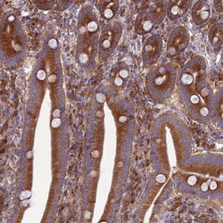 Invitrogen RPL17 Polyclonal Antibody 100 &mu;L | Buy Online | Invitrogen&trade; | Fisher Scientific