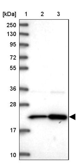 Invitrogen RPL17 Polyclonal Antibody 100 &mu;L | Buy Online | Invitrogen&trade; | Fisher Scientific