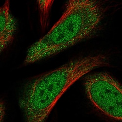Invitrogen CRTC3 Polyclonal Antibody 100 &mu;L; Unconjugated:Antibodies,