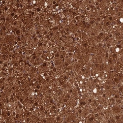 Invitrogen CRTC3 Polyclonal Antibody 100 &mu;L; Unconjugated:Antibodies,