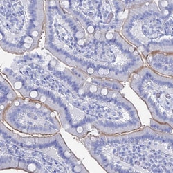 Invitrogen CD203c Polyclonal Antibody 100 &mu;L; Unconjugated:Antibodies,
