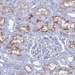Invitrogen CD203c Polyclonal Antibody 100 &mu;L; Unconjugated:Antibodies,