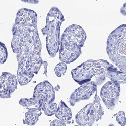 Invitrogen CD203c Polyclonal Antibody 100 &mu;L; Unconjugated:Antibodies,