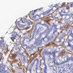 Invitrogen CD203c Polyclonal Antibody 100 &mu;L; Unconjugated:Antibodies,