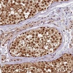 Invitrogen PPP4C Polyclonal Antibody 100 &mu;L; Unconjugated:Antibodies,