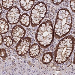 Invitrogen PPP4C Polyclonal Antibody 100 &mu;L; Unconjugated:Antibodies,