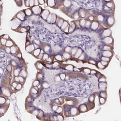 Invitrogen CUBN Polyclonal Antibody 100 &mu;L; Unconjugated:Antibodies,