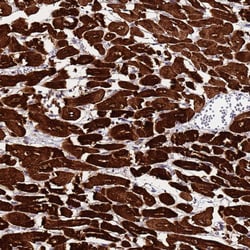 Invitrogen MYBPC3 Polyclonal Antibody 100 &mu;L; Unconjugated:Antibodies,