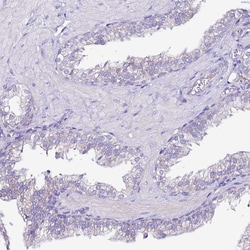 Invitrogen MYBPC3 Polyclonal Antibody 100 &mu;L; Unconjugated:Antibodies,