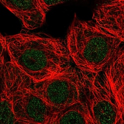 Invitrogen PLCB3 Polyclonal Antibody 100 &mu;L; Unconjugated:Antibodies,