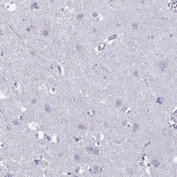Invitrogen PLCB3 Polyclonal Antibody 100 &mu;L; Unconjugated:Antibodies,
