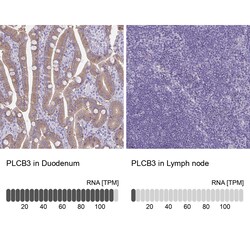 Invitrogen PLCB3 Polyclonal Antibody 100 &mu;L | Buy Online | Invitrogen&trade; | Fisher Scientific